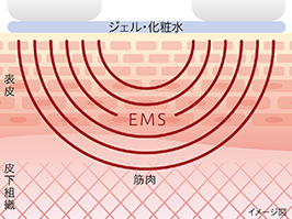 1_1-42 Hình ảnh: EMS