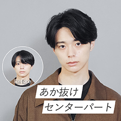 Hình ảnh: Phần giữa tóc trung tâm